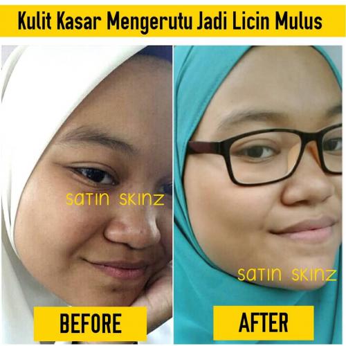 satin skinz testimoni glutathione vitamin c