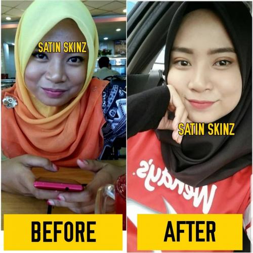 satin skinz testimoni glutathione vitamin c