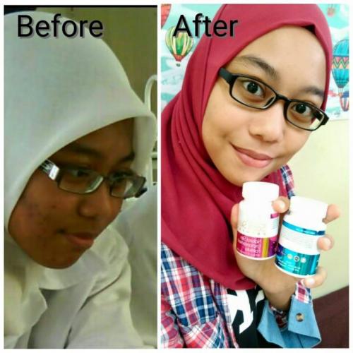 satin skinz testimoni kulit kusam