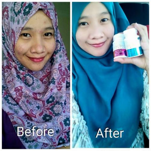 satin skinz testimoni kulit putih