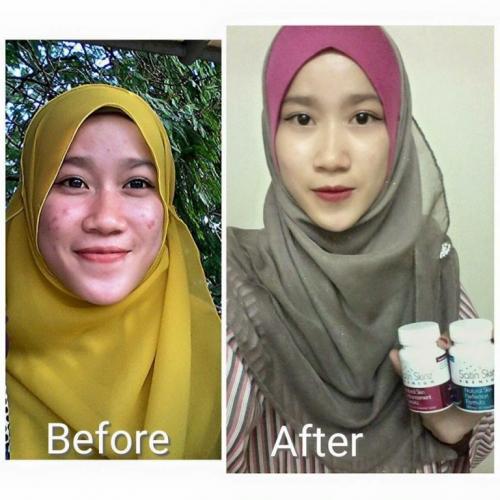 satin skinz testimoni kulit putih