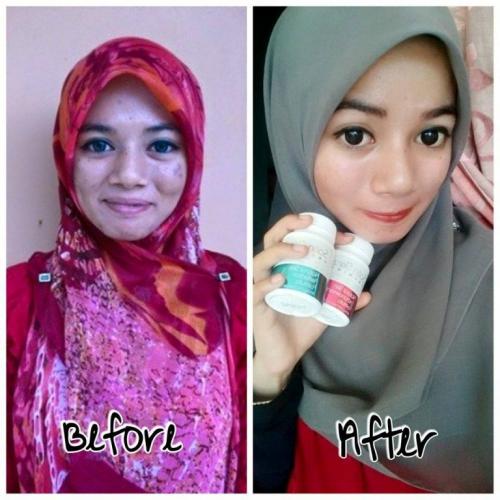 satin skinz testimoni kulit putih