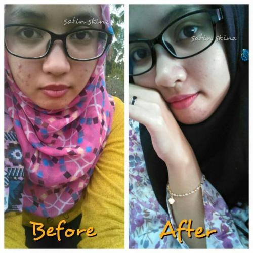 satin skinz testimoni kulit putih