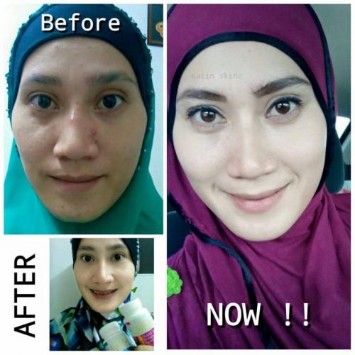 satin skinz testimoni kulit putih